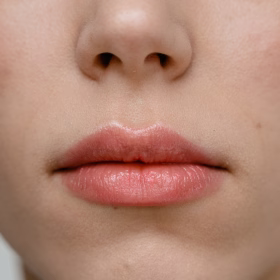 Armonización de labios en Bogotá con la doctora Steffanny Camargo