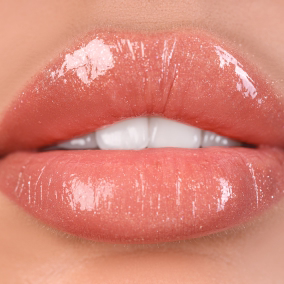 Russian Lips antes después mujer joven Bogotá resultado dramático natural