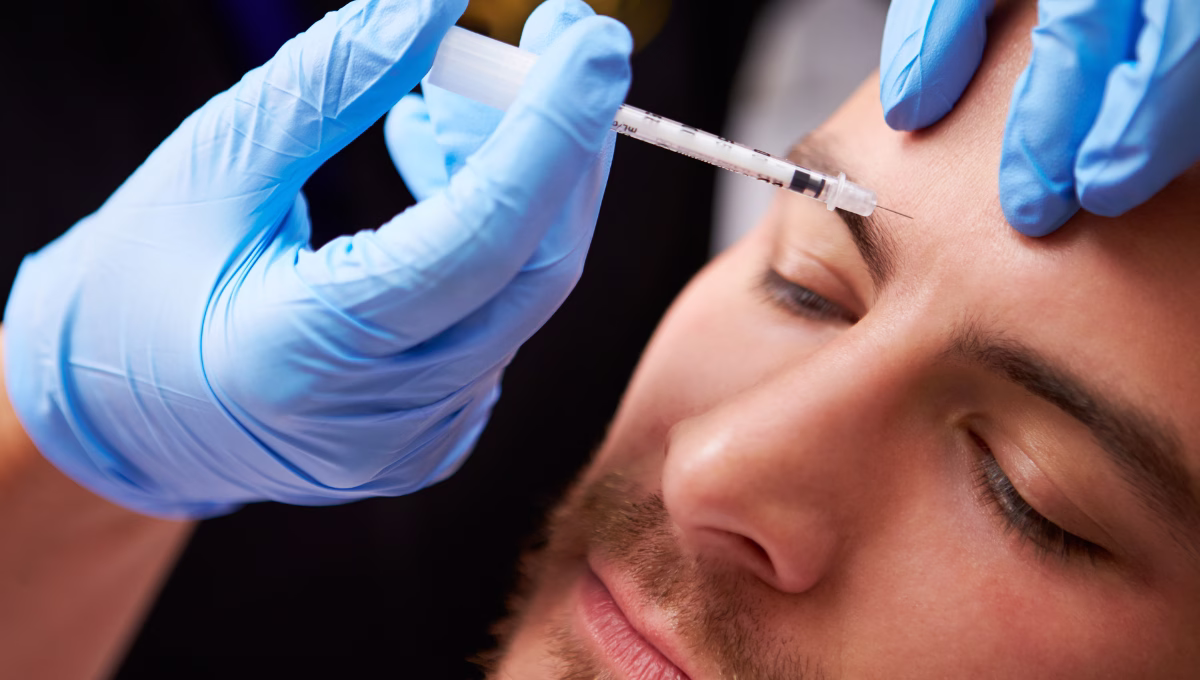 Mapa anatómico puntos aplicación Botox tercio superior facial