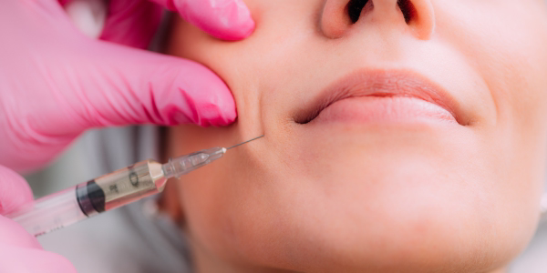 Comparación Restylane Refyne vs Juvederm Volift surcos nasogenianos