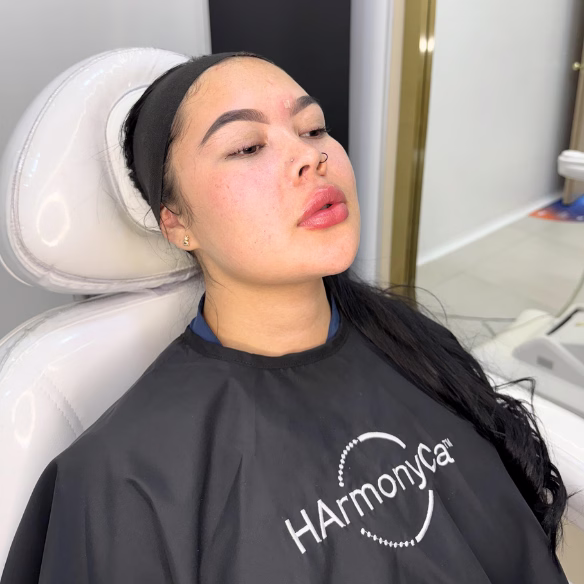 Testimonio en Bogotá: Relleno de labios con Juvederm certificado